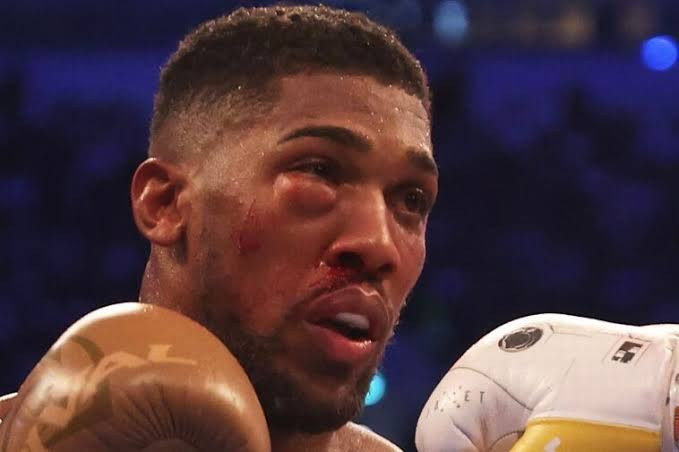 AnthonyJoshua-eye-socket.jpeg